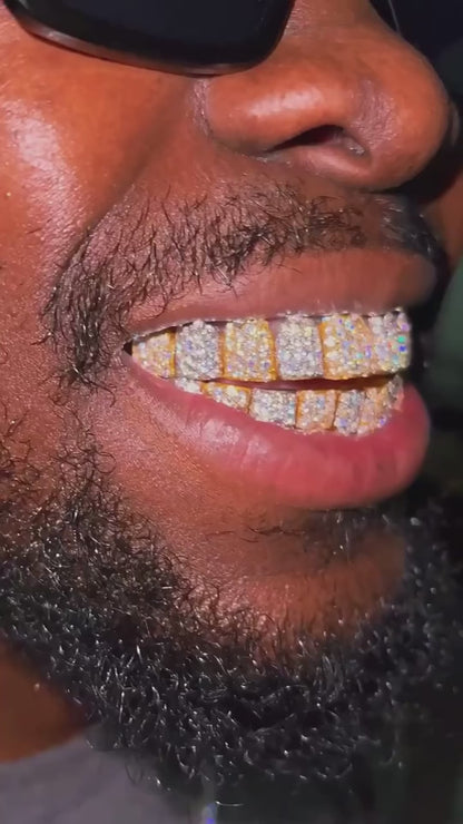 VVS1 Moissanite Diamond Custom Grillz